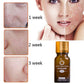 natural acne scar removal oil
